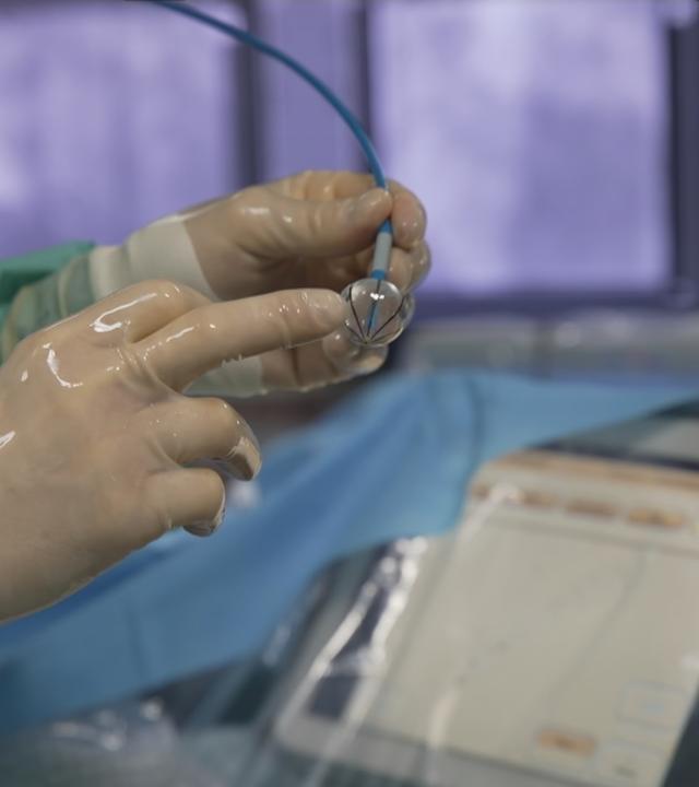 Neuer Katheter zur Behandlung von Vorhofflimmern
