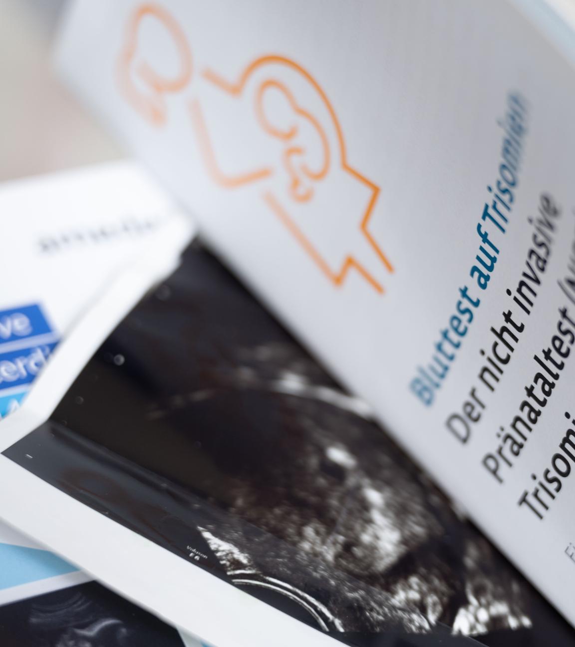  Zwei Informationsbroschüren zu nichtinvasiven Pränataltests liegen neben einem Ultraschallbild in einer Frauenarztpraxis. 