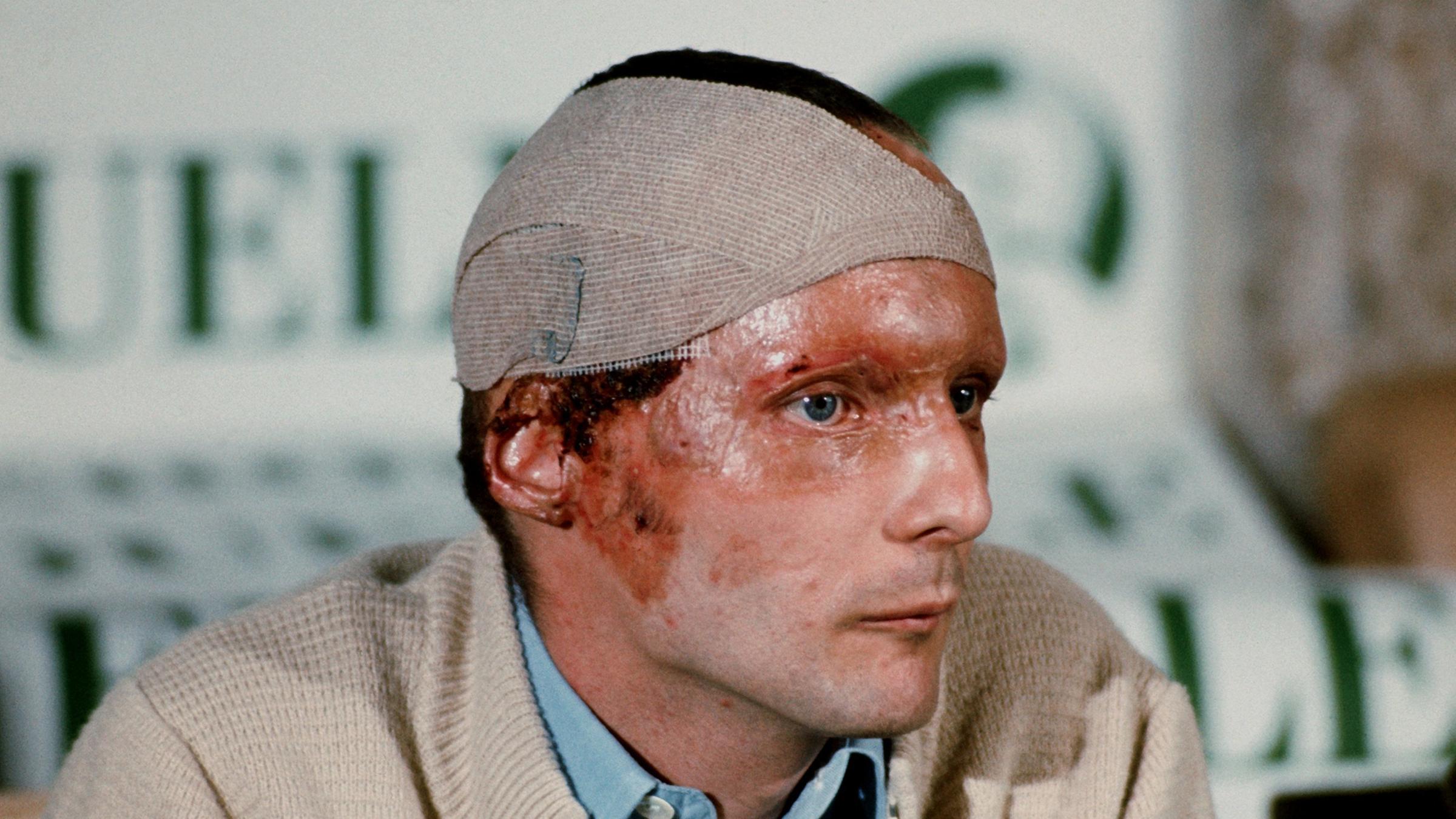 Niki Lauda bei Pressekonferenz nach Unfall