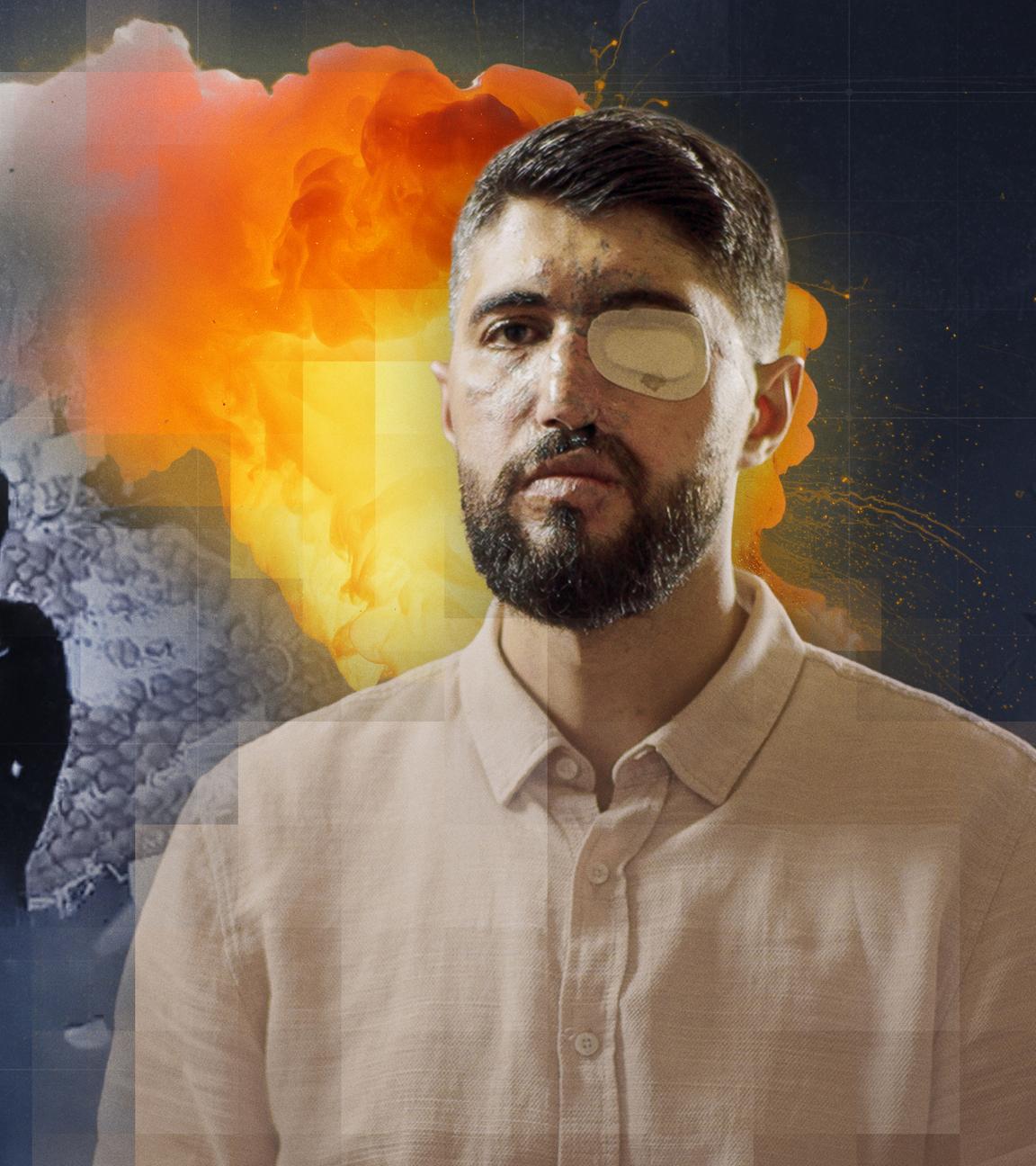 Montage: Menschen auf einem Gemüsemarkt in Beiruth, Libanon; Männliches Opfer mit Narben im Gesicht und Pflaster auf dem Auge