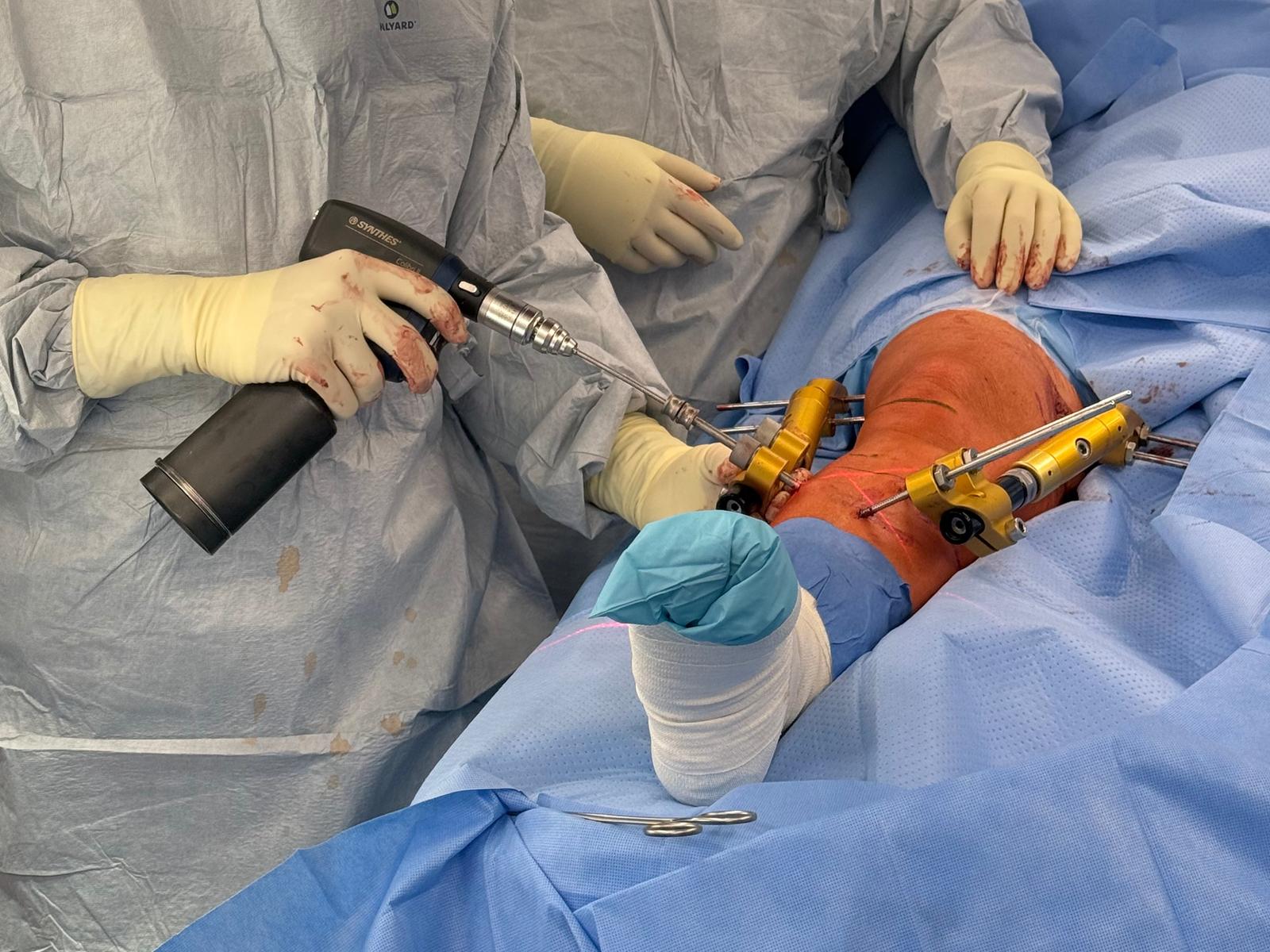 Arthrose im Knie: Verfahren kann knstliches Kniegelenk ersetzen