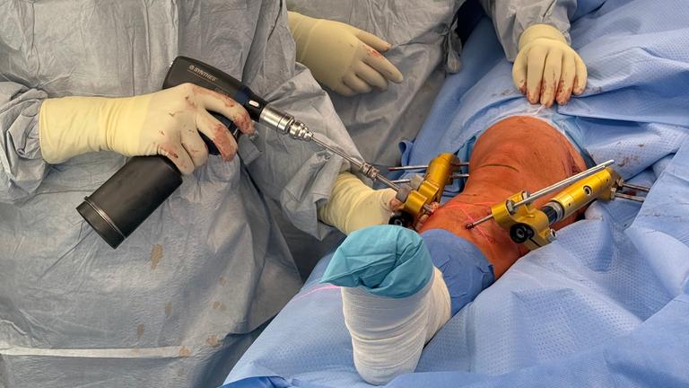 Zwei Ärzte führen eine Operation an einem Knie durch.