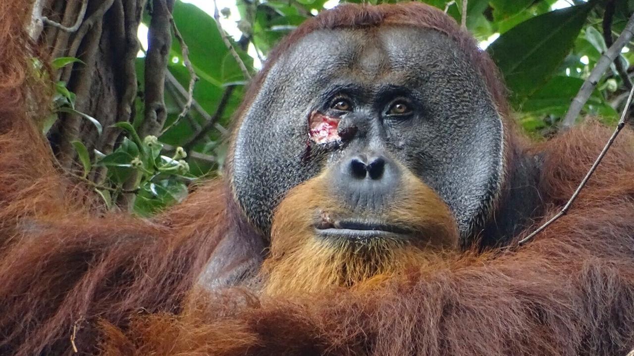 Eine Wunde im Gesicht von Rakus, einem wild lebenden männlichen Sumatra-Orang-Utan im Gunung-Leuser-Nationalpark, Indonesien, am 23.06.2022.