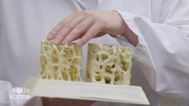 Osteoporose: Plötzlicher Knochenbruch