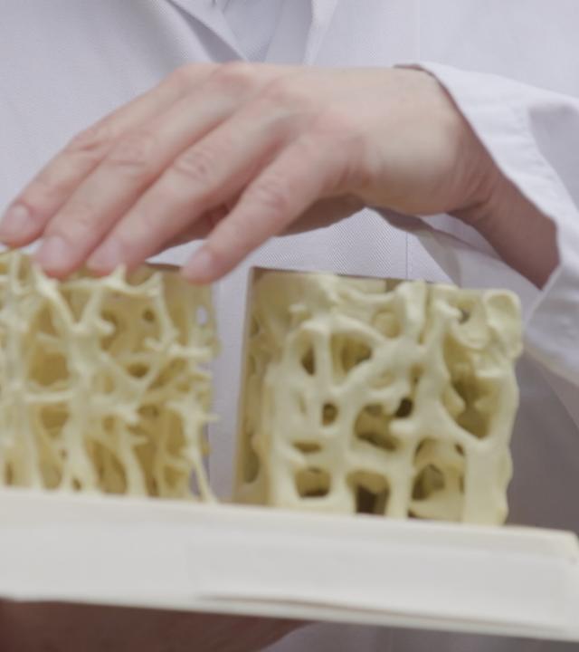 Osteoporose: Plötzlicher Knochenbruch