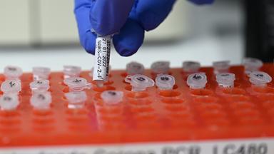 Eine Mitarbeiterin des PCR Testlabors des Robert Bosch Krankenhauses bereitet PCR Tests vor.