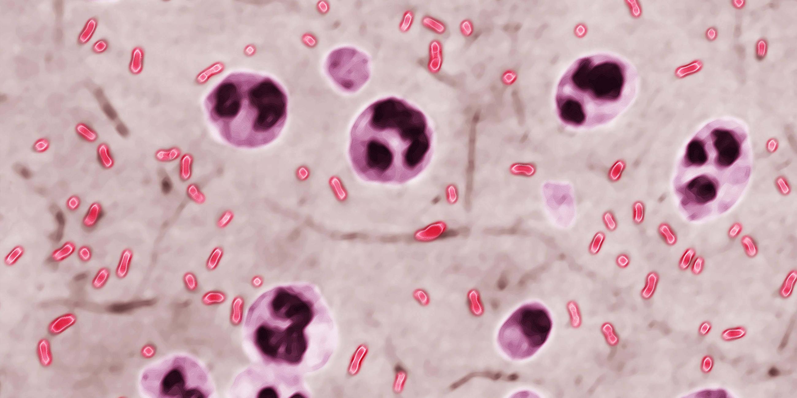 Yersinia pestis (Pasteurella pestis) ist das Bakterium, das für die Beulenpest verantwortlich ist. Optische Mikroskopie X 2000