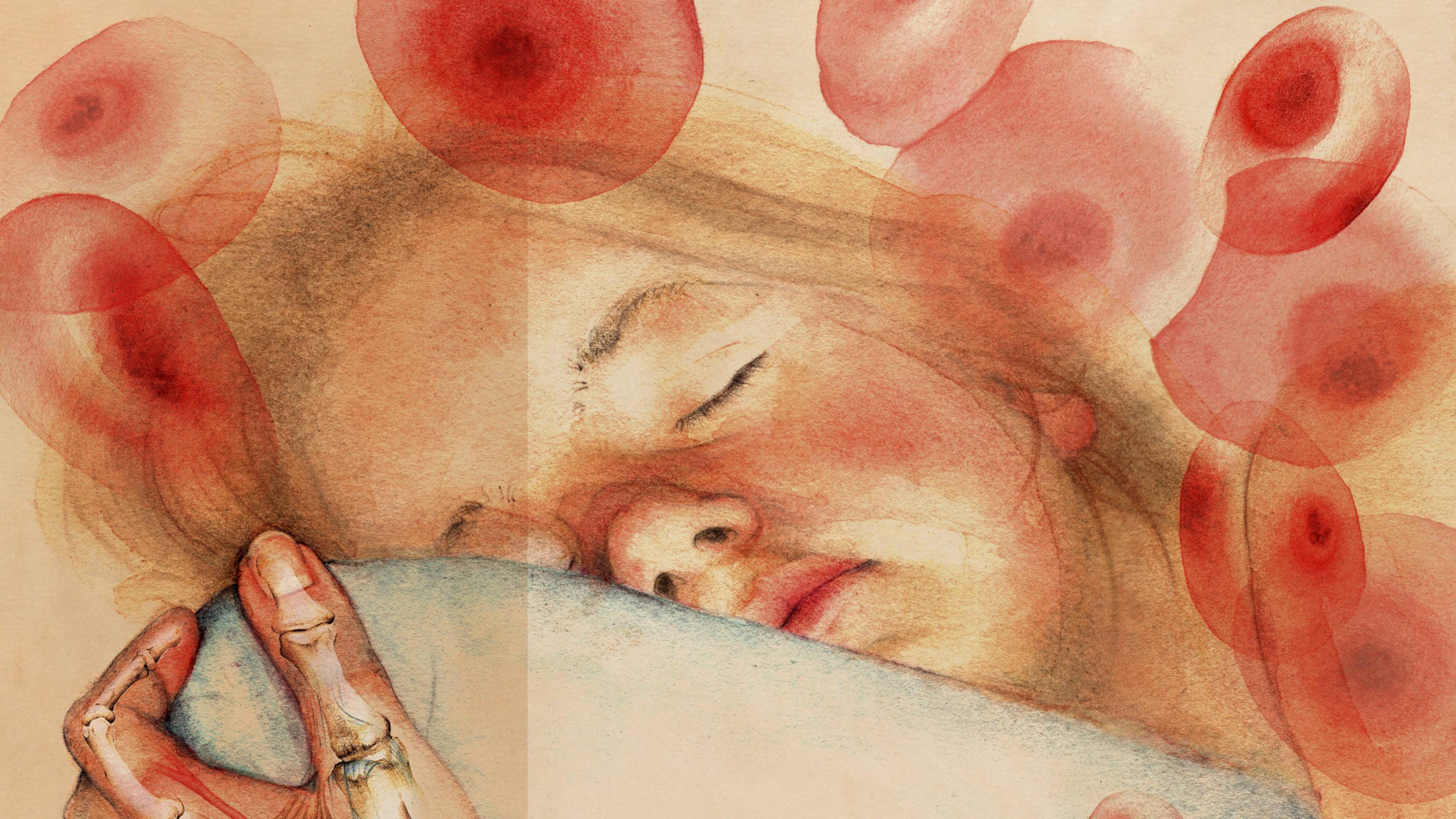 Polyarthritis bei Kindern