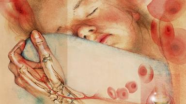 Polyarthritis bei Kindern