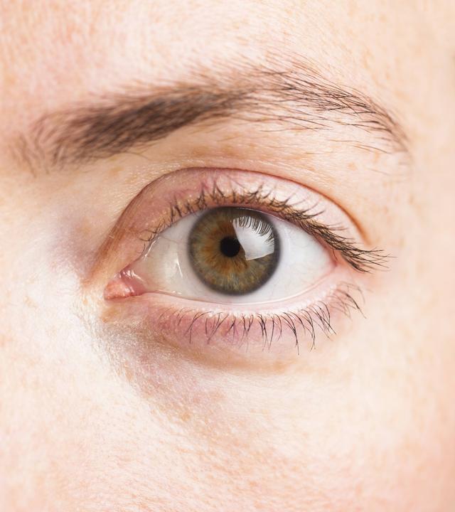 Geöffnetes Auge