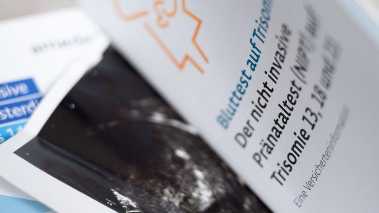 Zwei Informationsbroschüren zu nichtinvasiven Pränataltests liegen neben einem Ultraschallbild in einer Frauenarztpraxis. (Archiv)