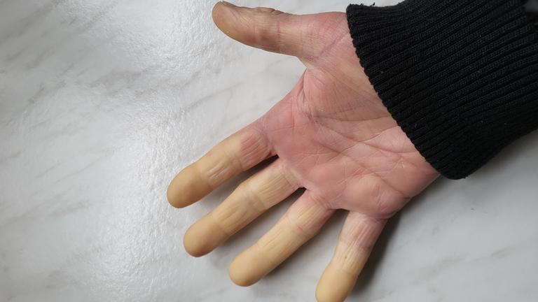 Handfläche mit weißen Fingern