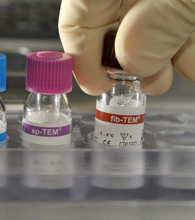 In einem Labor des medizinischen Forschungszentrums am Universitätsklinikum Jena werden reagenzien Zusammengestellt, die für den Gerinnungstest einer Blutprobe benötigt werden.