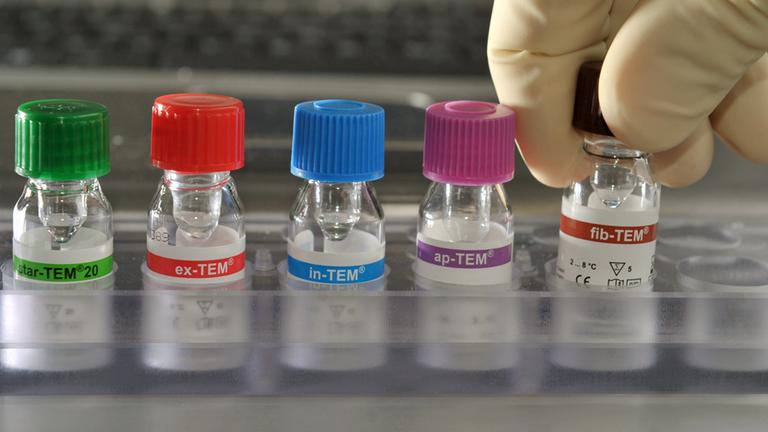 In einem Labor des medizinischen Forschungszentrums am Universitätsklinikum Jena werden reagenzien Zusammengestellt, die für den Gerinnungstest einer Blutprobe benötigt werden.