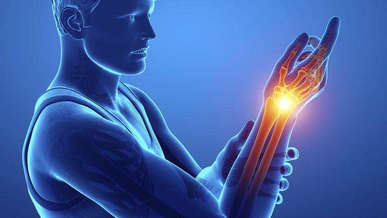 Grafik Mann mit Handgelenksschmerzen