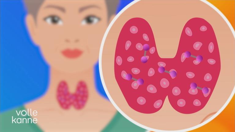 Grafik auf der eine Schilddrüse zu sehen ist