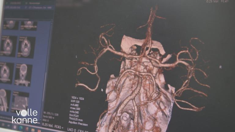 Radiologisches Bild vom Herzen