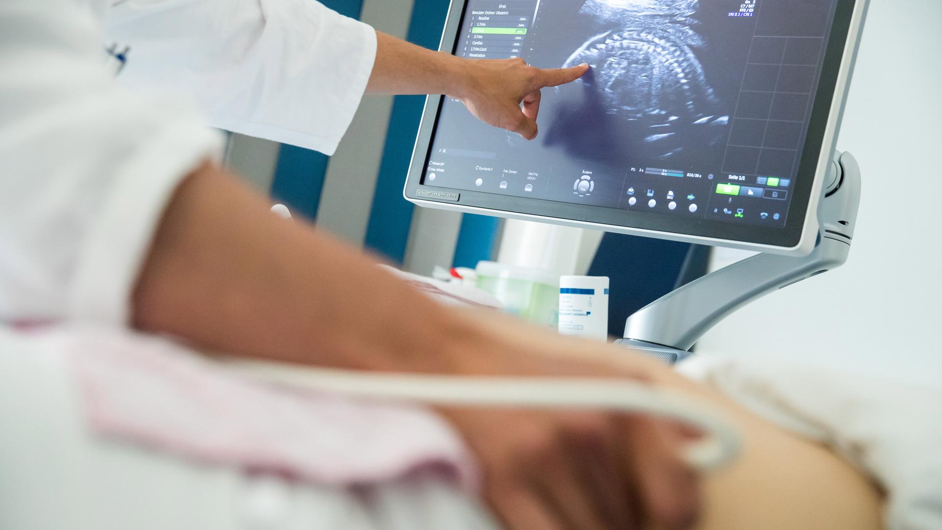 Ultraschall-Untersuchung bei einer Schwangeren