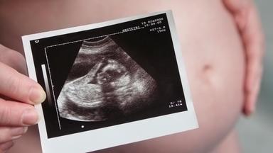 Im Hintergrund sieht man einen Schwangerschaftsbauch, welcher durch ein Ultraschallbild verdeckt wird.