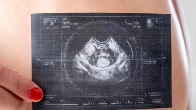 Eine schwangere Frau im Hintergrund zeigt ein Ultraschallbild in die Kamera.