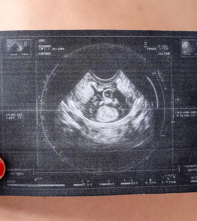 Eine schwangere Frau im Hintergrund zeigt ein Ultraschallbild in die Kamera.