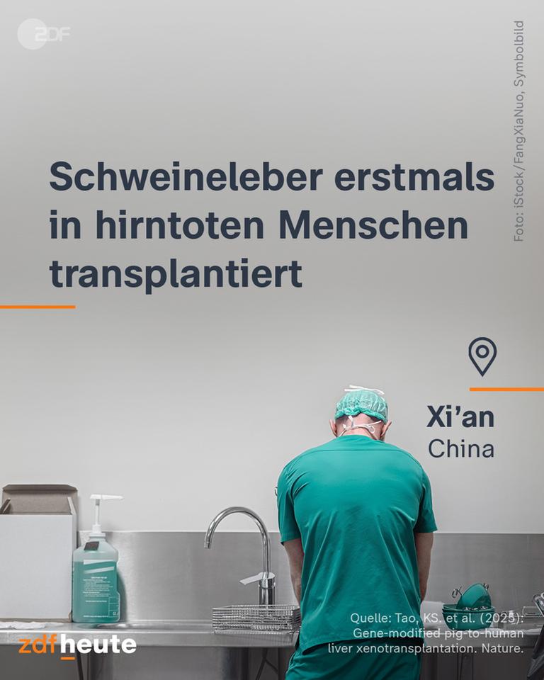 Ein Mann in OP-Kleidung wäscht sich vor einer Operation ein.