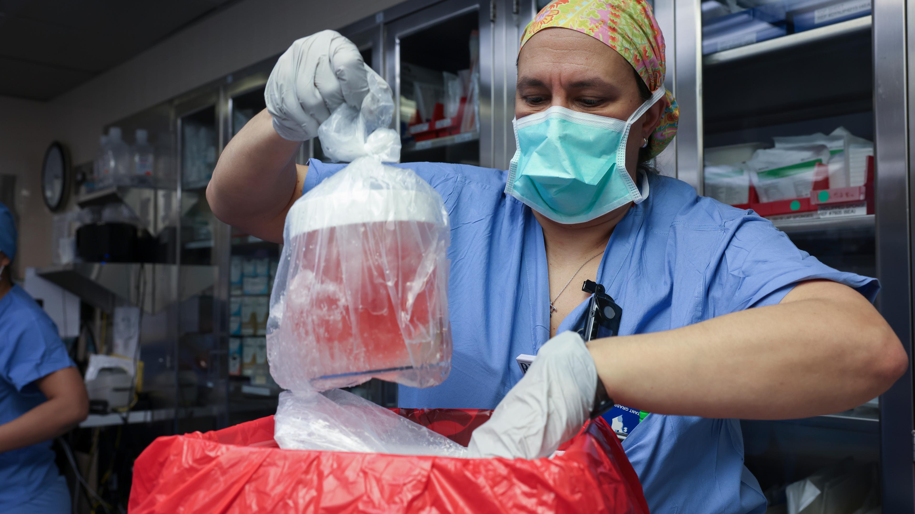USA, Boston: Melissa Mattola-Kiatos nimmt vor der Transplantation einer Schweineniere im Massachusetts General Hospital die Niere aus einer Transport- und Kühllbox.USA, Boston: Melissa Mattola-Kiatos nimmt vor der Transplantation einer Schweineniere im Massachusetts General Hospital die Niere aus einer Transport- und Kühllbox.