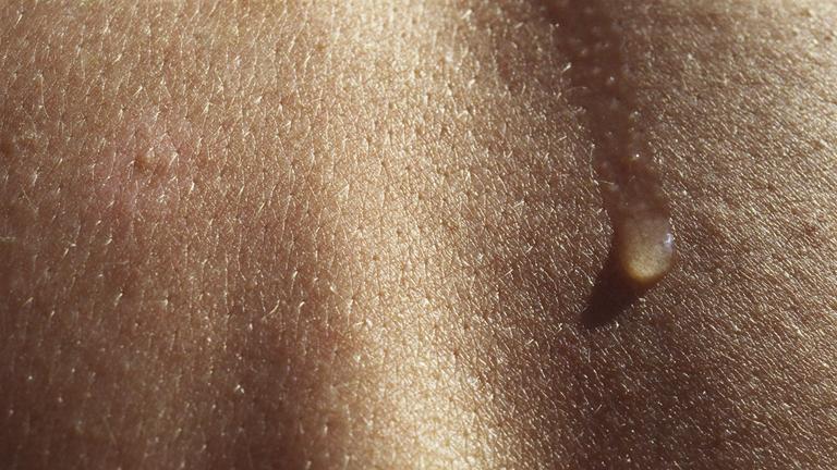 Schweißtropfen auf Rücken.