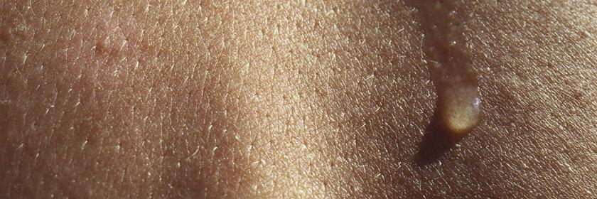 Schweißtropfen auf Rücken.