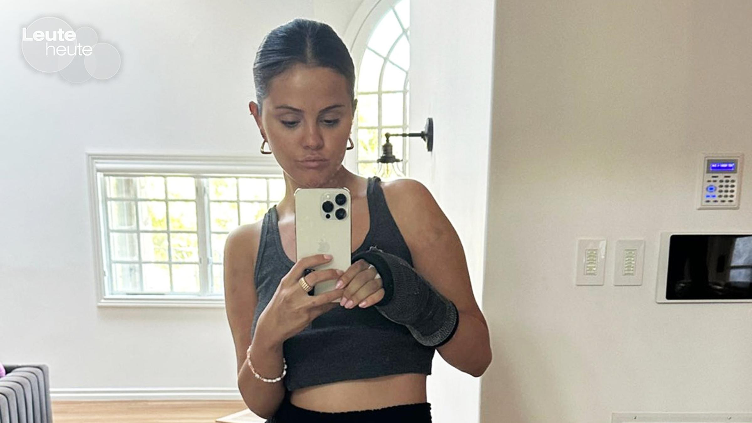 Selena Gomez zeigt den Bruch ihres Handgelenkes.