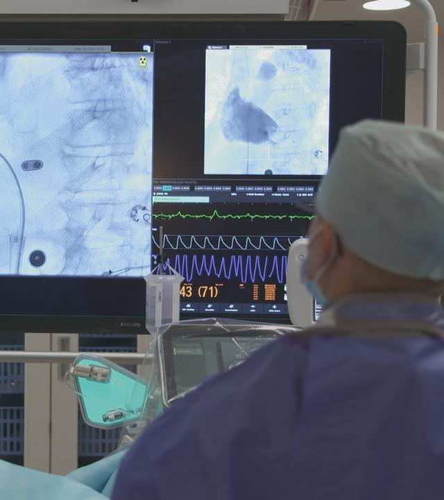 Das Bild zeigt eine OP, bei der ein sondenloser Herzschrittmacher eingesetzt wird. Zusehen sind die Ultraschallbilder des Schrittmachers.