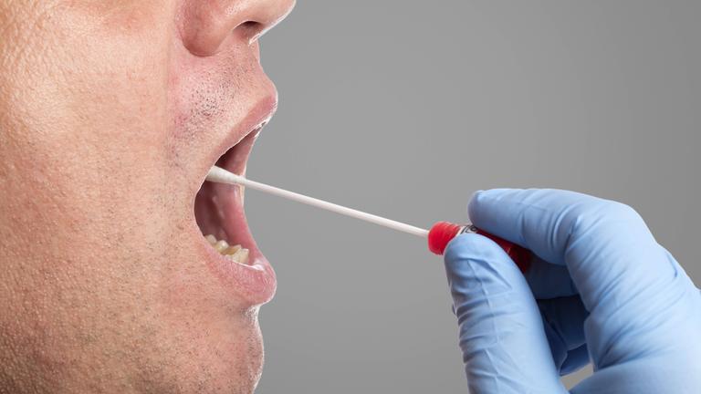 Ein Mann bekommt mit einem Wattestäbchen an der Wangenschleimhaut einen Abstrich gemacht.