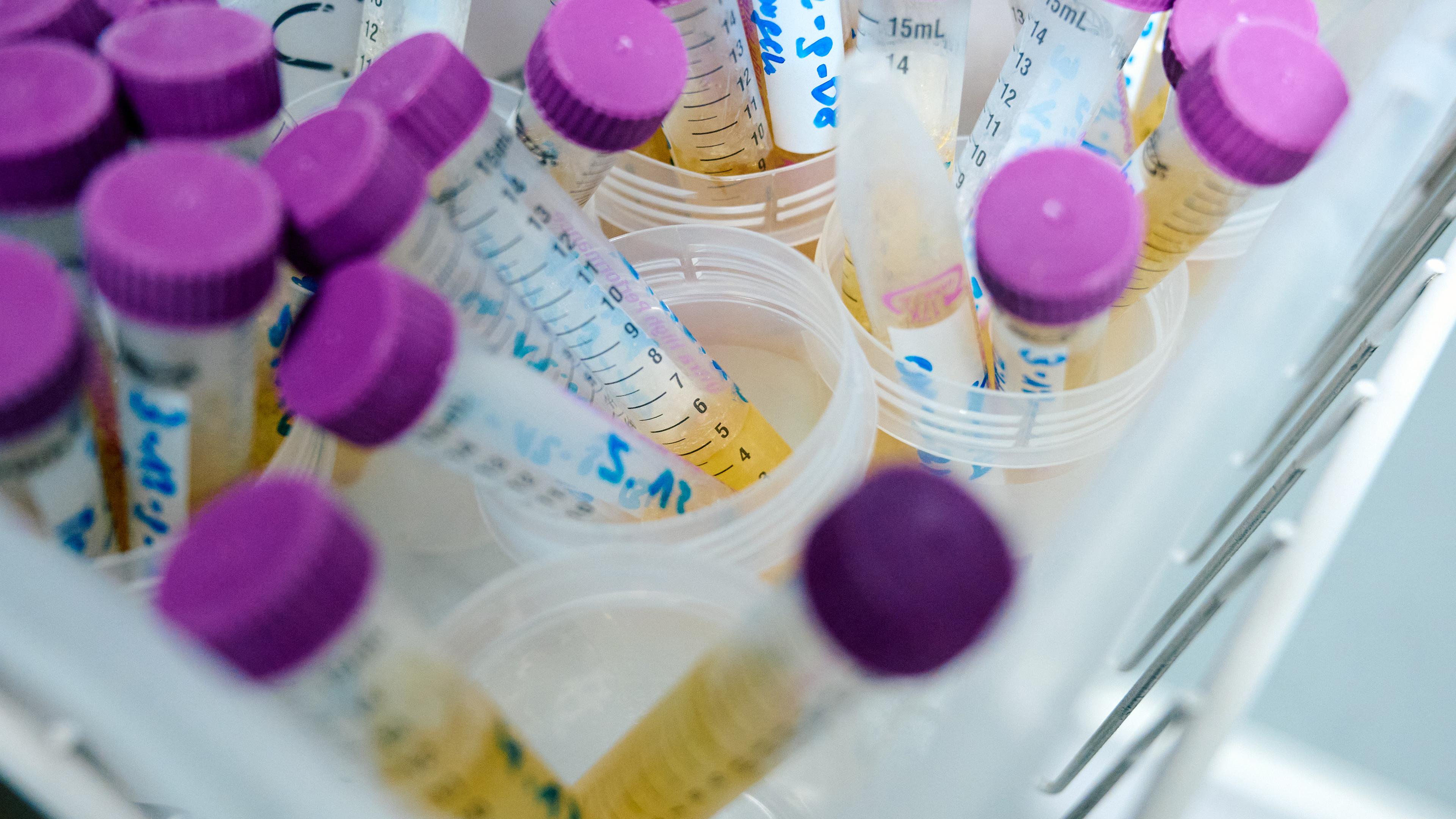 Nordrhein-Westfalen, Essen: Tiefgefrorene Urinproben liegen in einem Labor des Landesamt für Natur, Umwelt und Verbraucherschutz (Lanuv) Nordrhein-Westfalen in einem Kühlschrank.