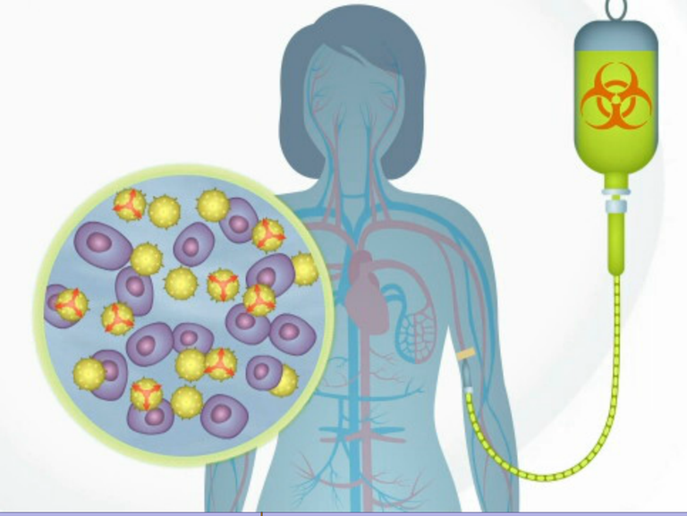 Stammzellentherapie bei MS