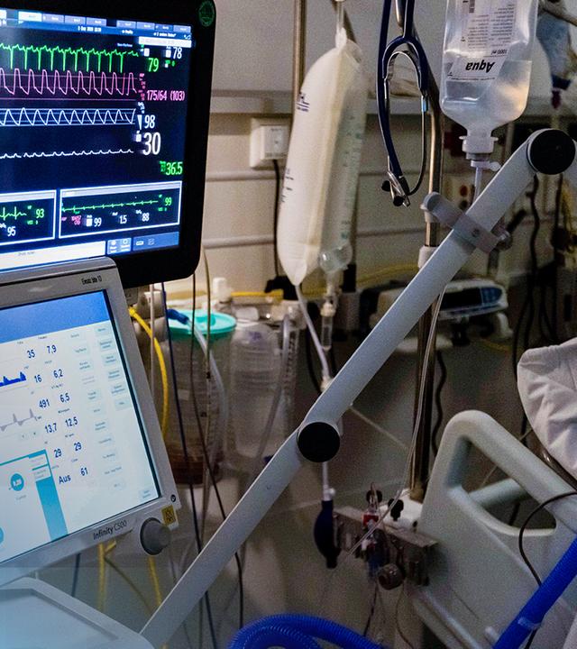 Mehrere Schläuche, Infusionsbeutel und zwei Monitore sind neben einem Krankenbett angebracht.