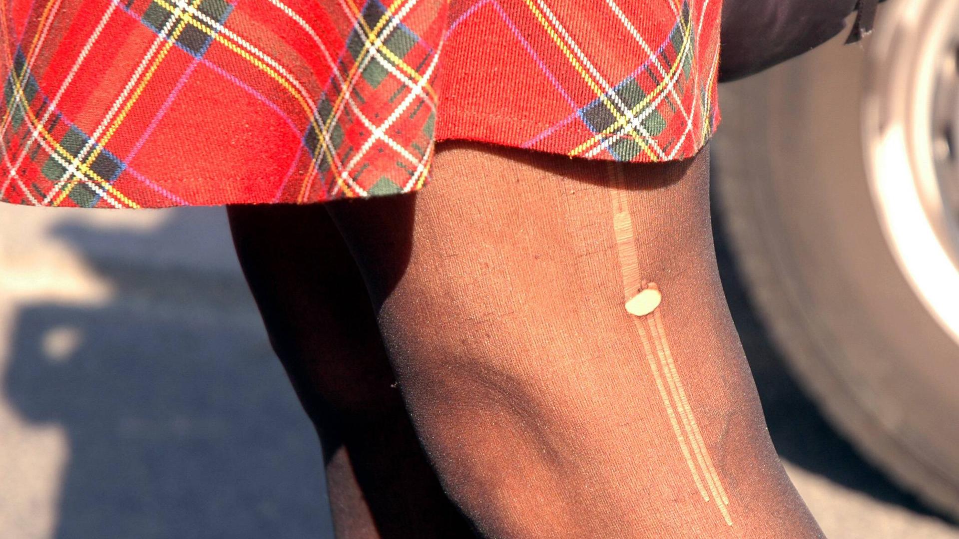 Laufmasche an einem Frauenbein