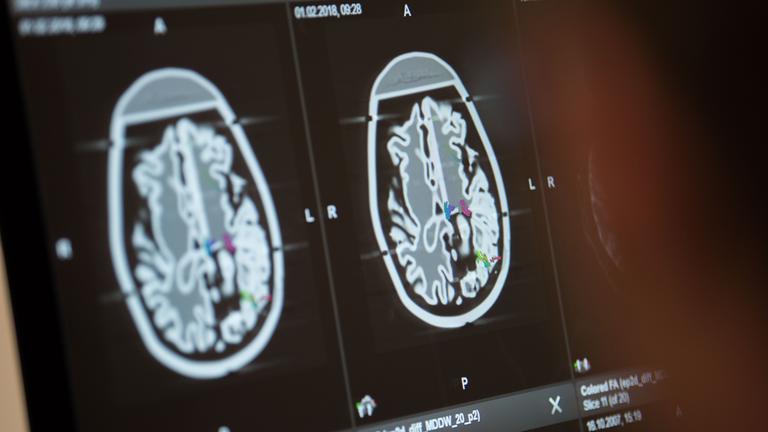 CT-Bilder von einem Gehirn