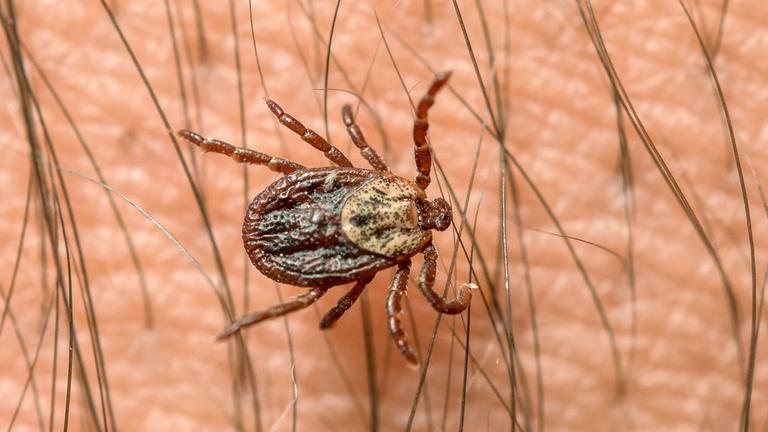 Eine Zecke krabbelt über den Arm eines Mannes. Archivbild