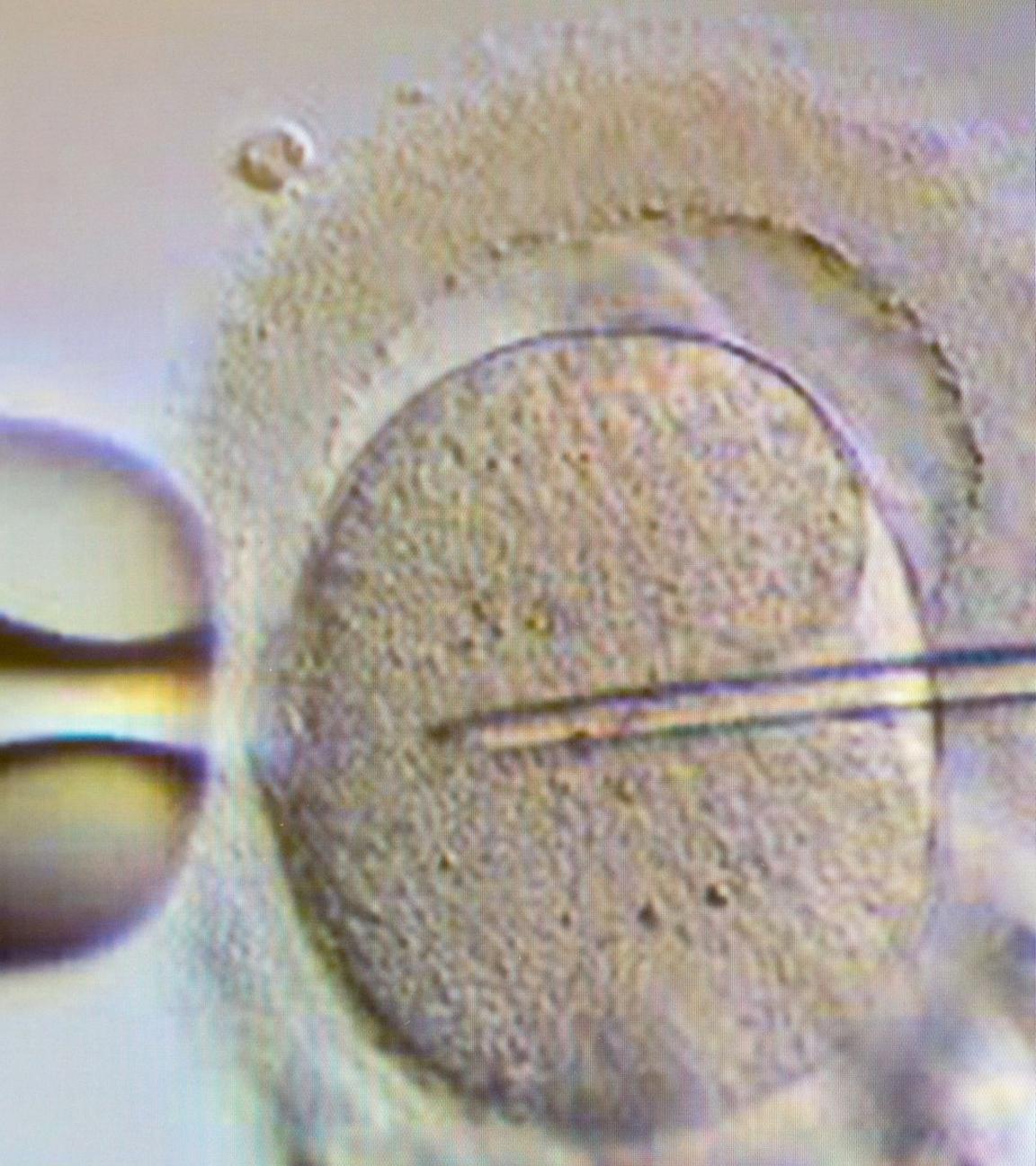 Künstliche Befruchtung. Archivbild