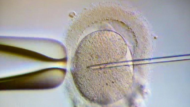 Künstliche Befruchtung. Archivbild