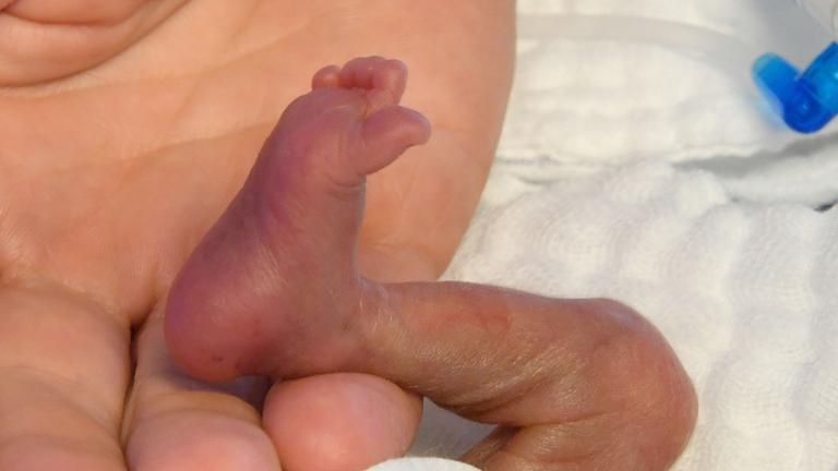 WHO sieht Frühchen in Gefahr.