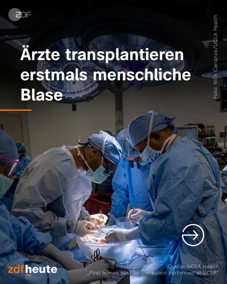 Graphik zu "Ärzte transplantieren erstmals menschliche Blase"