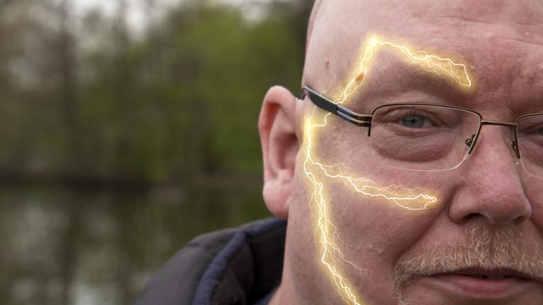 Ein Mann mittleren Alters mit Brille schaut in die Kamera. Auf der linken Seite seines Gesichts verlaufen gelb leuchtenden Linien. Sie symbolisieren den Trigeminusnerv mit seinen drei Ästen.