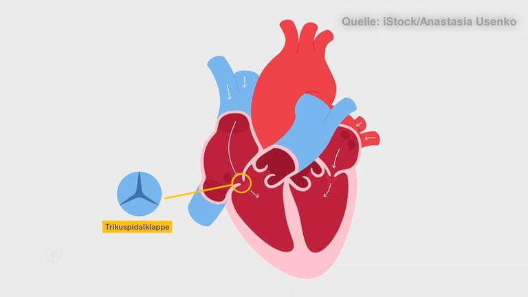 Eine visuelle Darstellung des Herzens, in der die Trikuspidalklappe gekennzeichnet ist