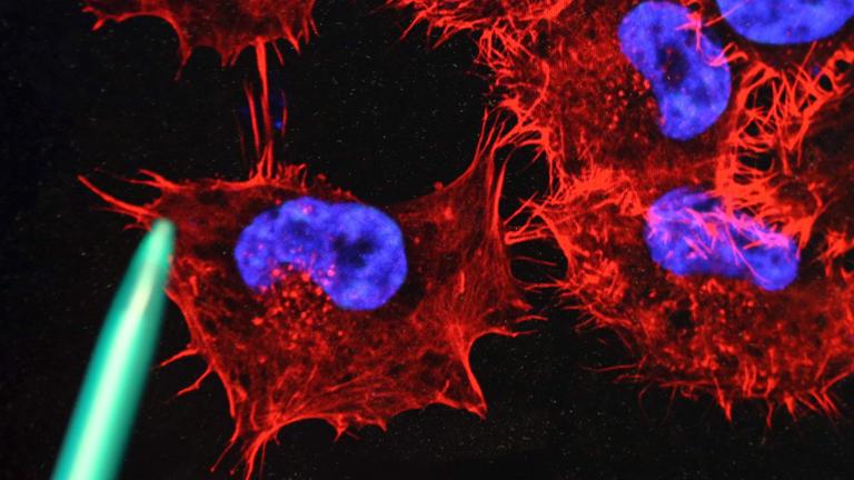 Archiv: Tumor-Metastasierung am 22.10.2013 in Rostock