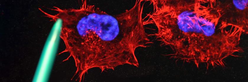 Archiv: Tumor-Metastasierung am 22.10.2013 in Rostock