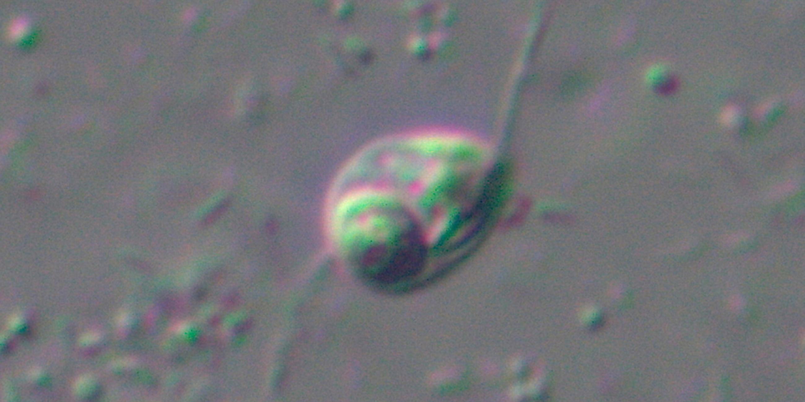 Ancoracysta twista