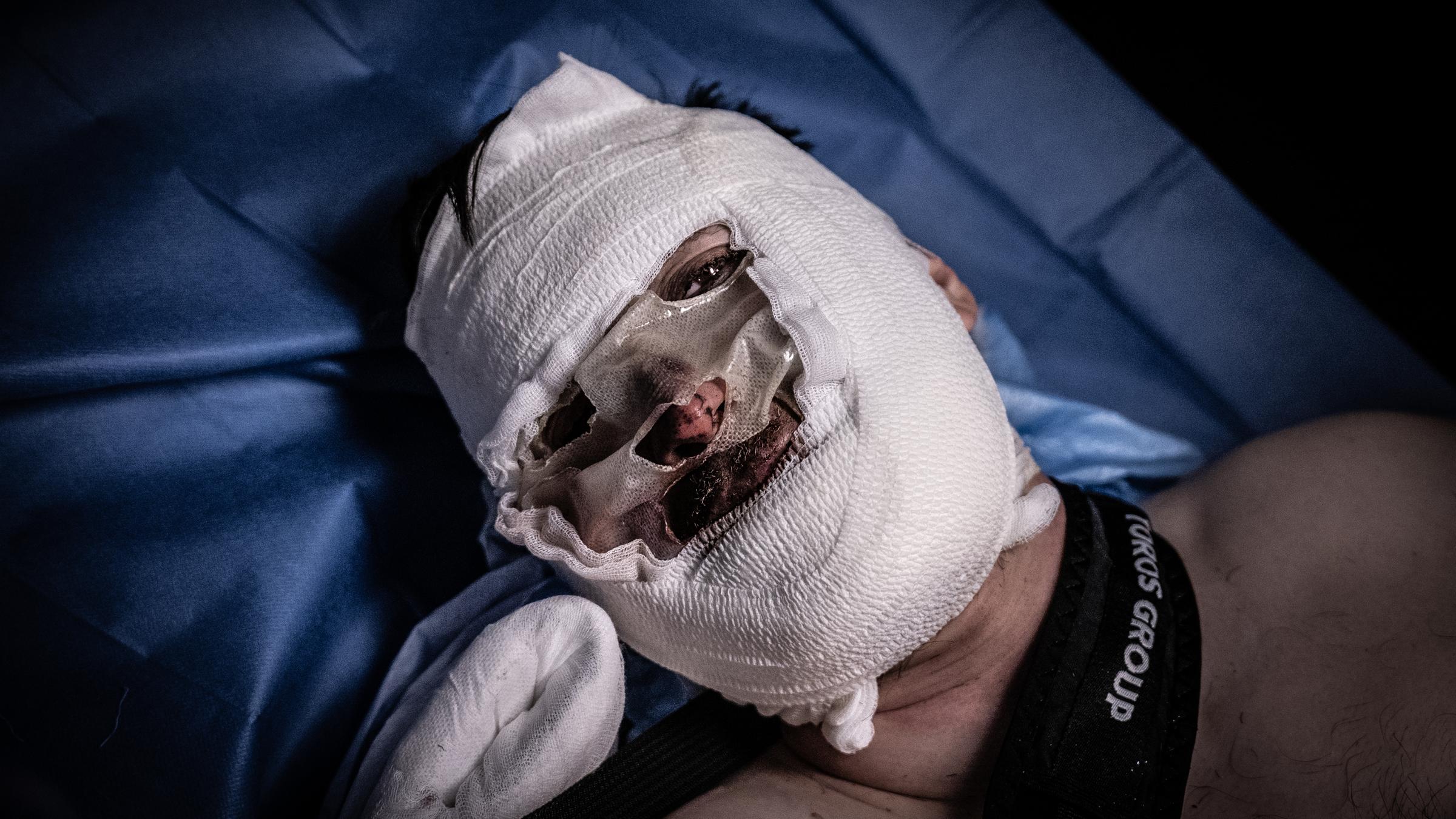 Der Kopf eines Mannes ist mit Mullbinden verbunden, nur seine Augen, Nase und Mund sind zu sehen, er blutet.
