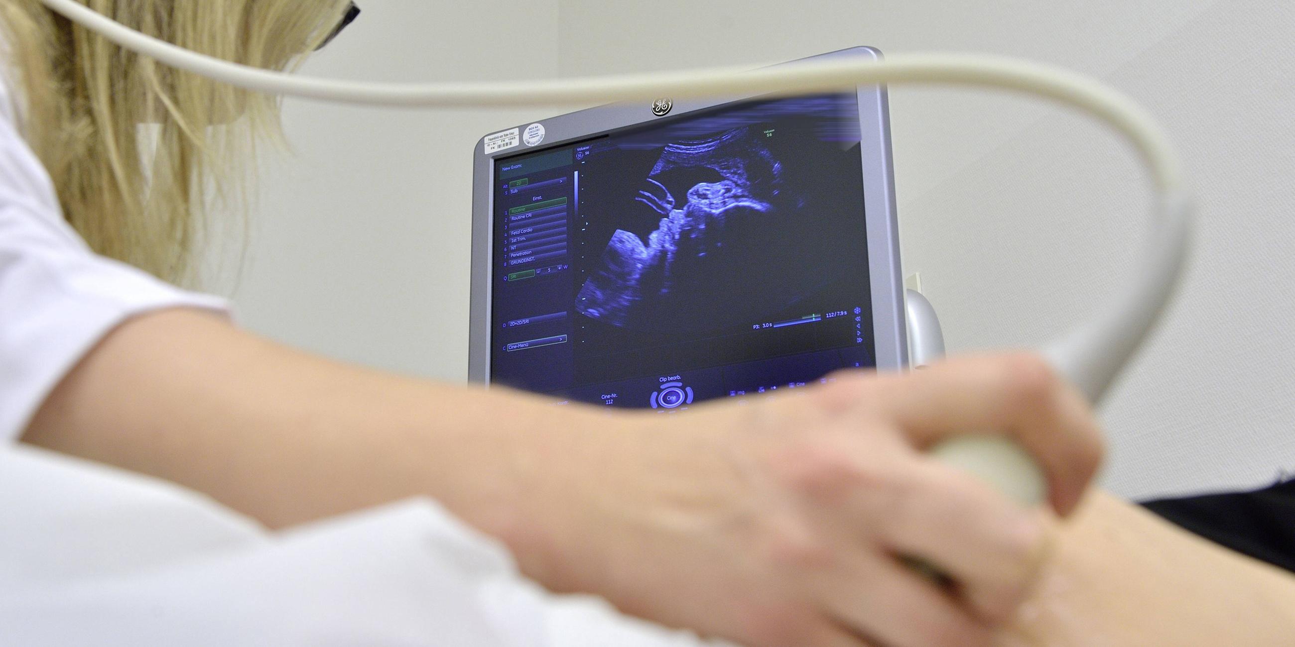 Ultraschall eines Embrios