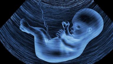 Ultraschallbild eines Embryos